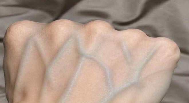 If your veins are visible in your hand, it is a signal