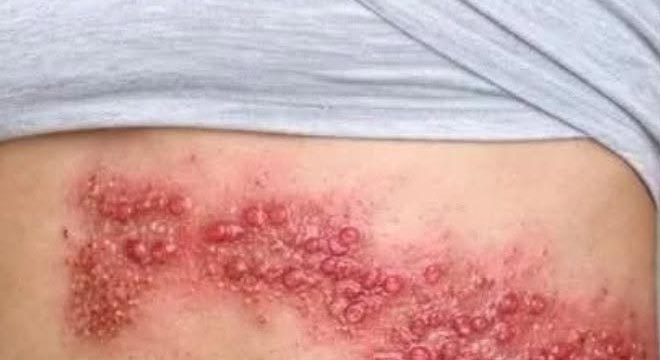 The Nightmare in Your Sheets: Why That Unwashed Bed Is Inviting a Creepy-Crawly Invasion