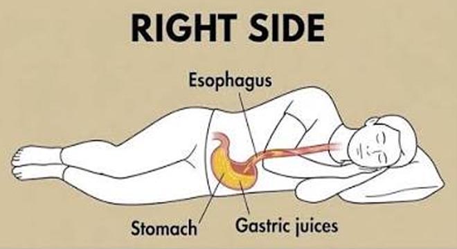 Does Sleeping on Your Right Side Help or Worsen Snoring?