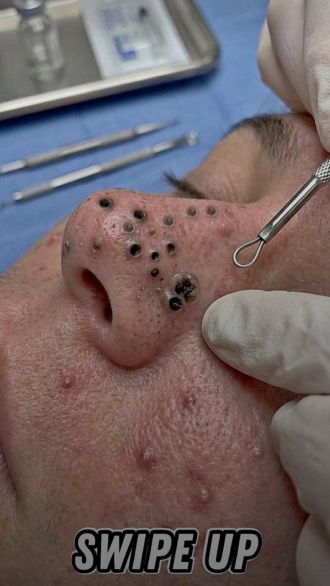 The Nose Knows: 6 Things Your Nose Tells You About Your Health ( Watch videos at the end)