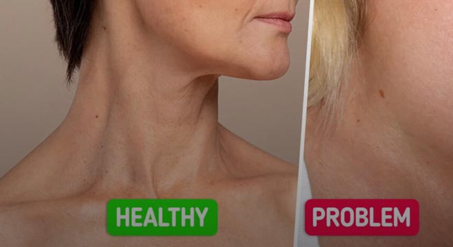 6 Warning Signs Your Thyroid Might Be in Trouble