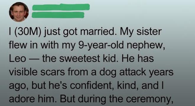 My In-Laws Tried to Ban My Scarred Nephew from Our Wedding — My Wife’s Response Left Them Speechless